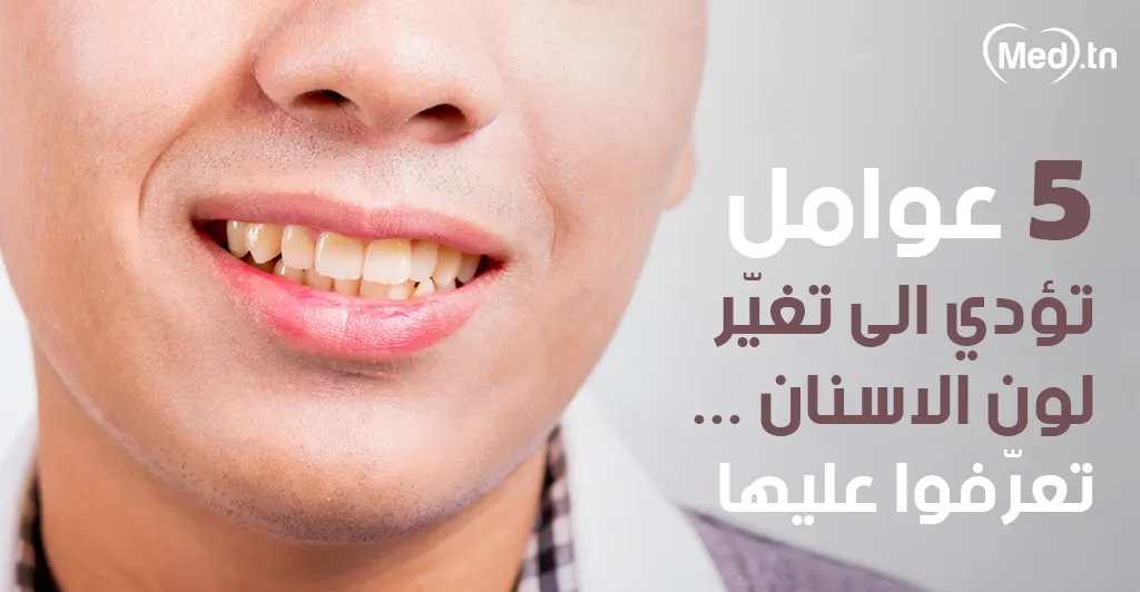 5 عوامل تؤدي الى تغيّر لون الاسنان... تعرّفوا عليها